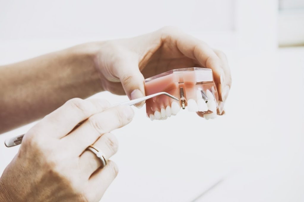 Dental assistant holding a dental model